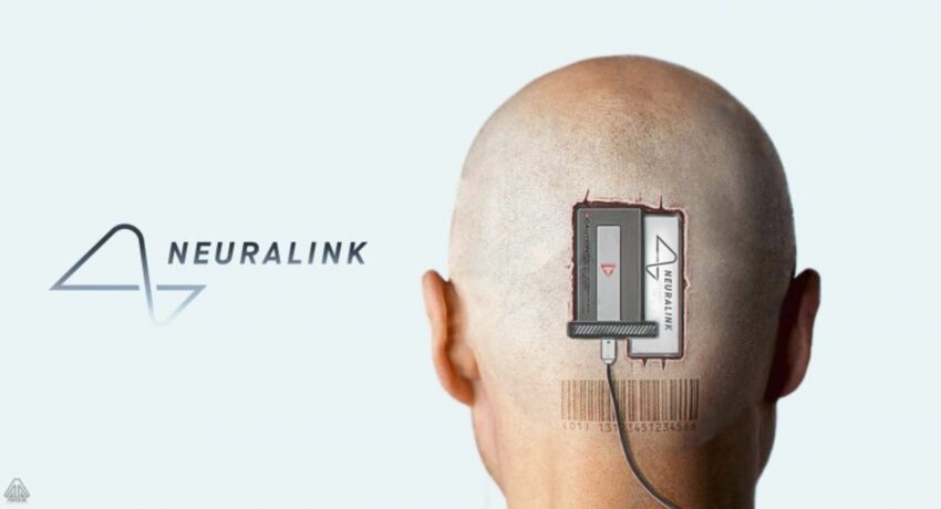 Проблеми з електродами в мозковому імпланті Neuralink - перші результати та потенційні ризики