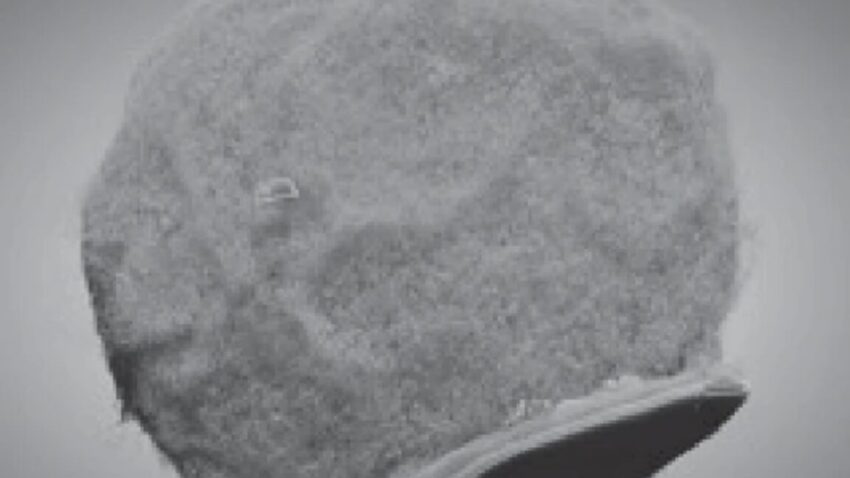 Мікрочіпи подорожують з імунними клітинами до вогнищ запалення: нові відкриття в медицині